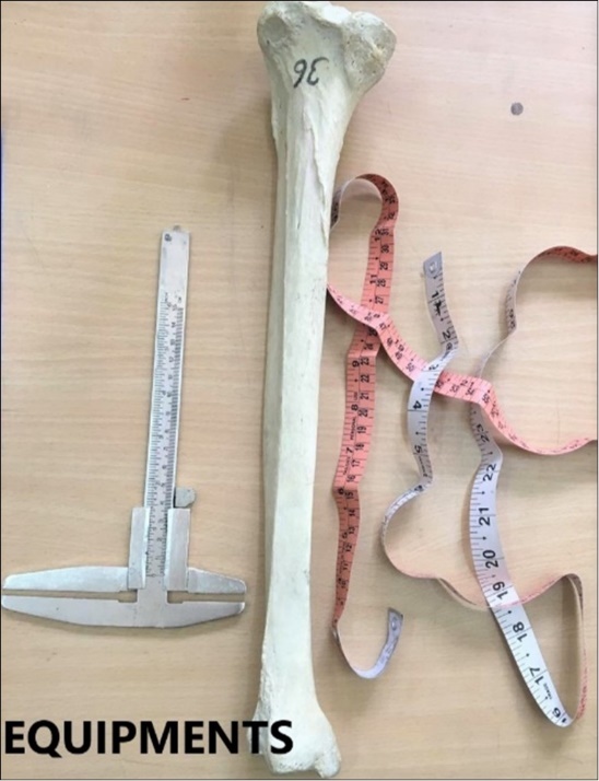  Measurements done on tibia using Vernier caliper and measuring tape