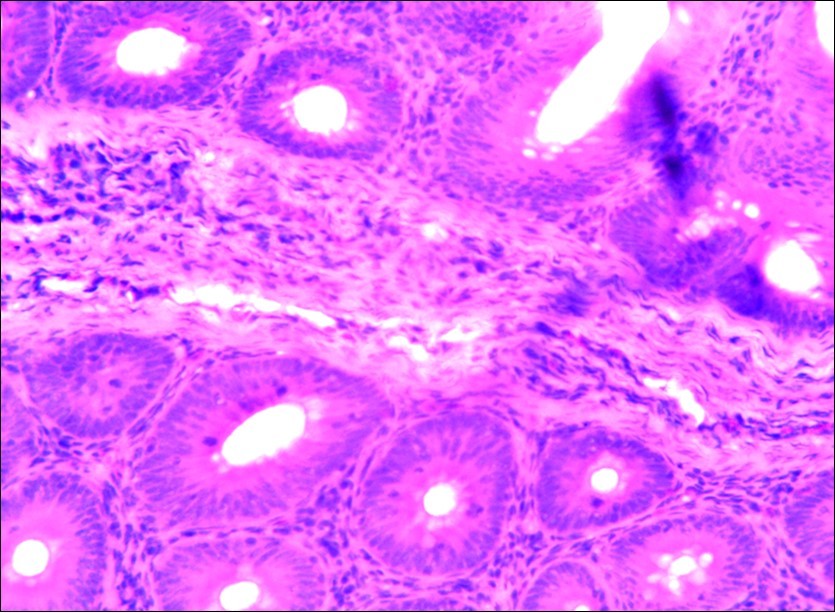  Photomicrograph of caecum of chick uninfected and untreated showing no    observable lesion X250 (H&E).