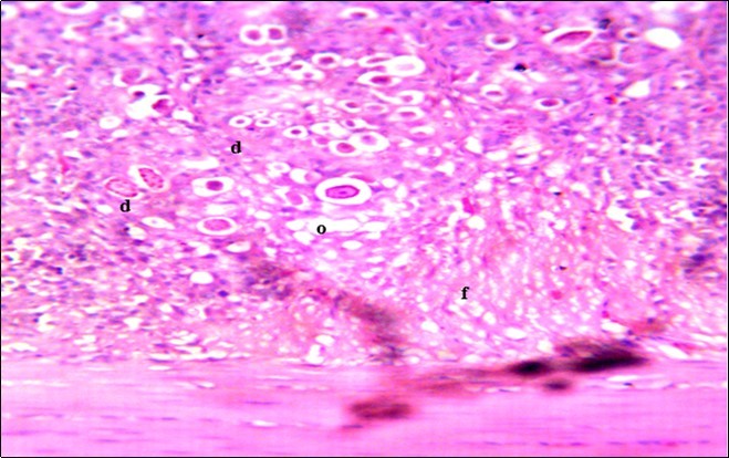  Photomicrograph of caecum of chick administered 20000 Oocysts of Eimeria                   tenella and treated with NeemAzal® Oil showing generalized degeneration of the caecal glands (d), moderate Ocysts presence (o) with fibrosis (f) X250 (H & E).