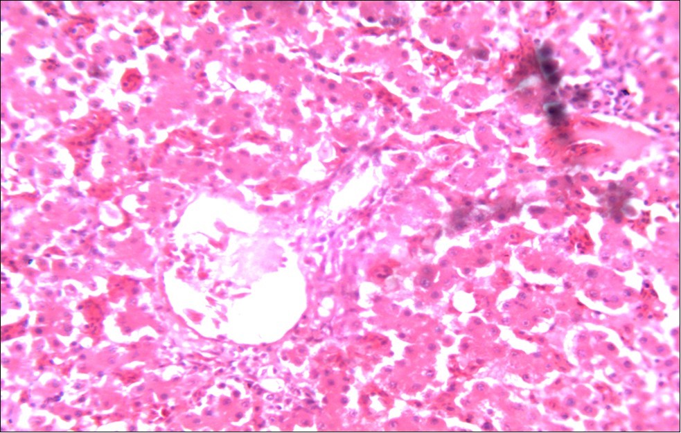  Photomicrograph of liver of chick administered NeemAzal® at 200 mg/kg showing no                  observable lesion X250 (H & E)