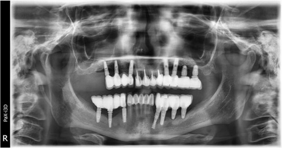 Panoramic overview picture before rehabilitation 06.2022