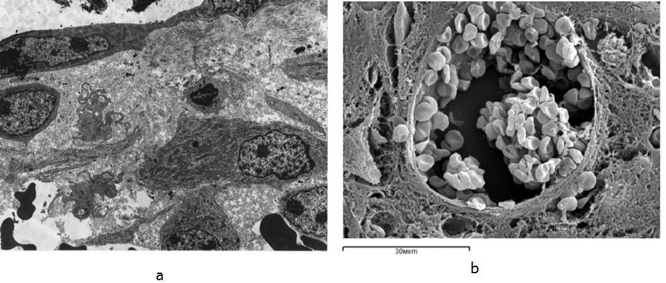  The ultrastructure of the intermediary zone of regeneration 7 days after the operation in the animals of the control group: a – transmission electron microscopy, b – scanning electron microscopy. Increase: a – 6000, b – 2000