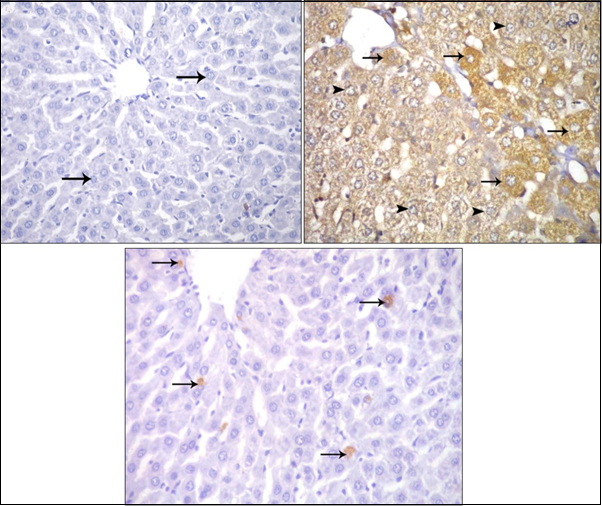  Photomicrographs of sections in the liver: (a) Control adult albino rat showing negative immune reaction for caspase 3 inside the cytoplasm of hepatocytes (arrow).                                     (b) ZnONPs-treated adult albino rat showing strong positive immune reaction for caspase 3 inside the cytoplasm of                  hepatocytes. (c) ZnONPs & VE-treated adult albino rat showing weak positive immune reaction for caspase 3 inside the                   cytoplasm of hepatocytes. (Immunoperoxidase technique for caspase 3   X 400) 