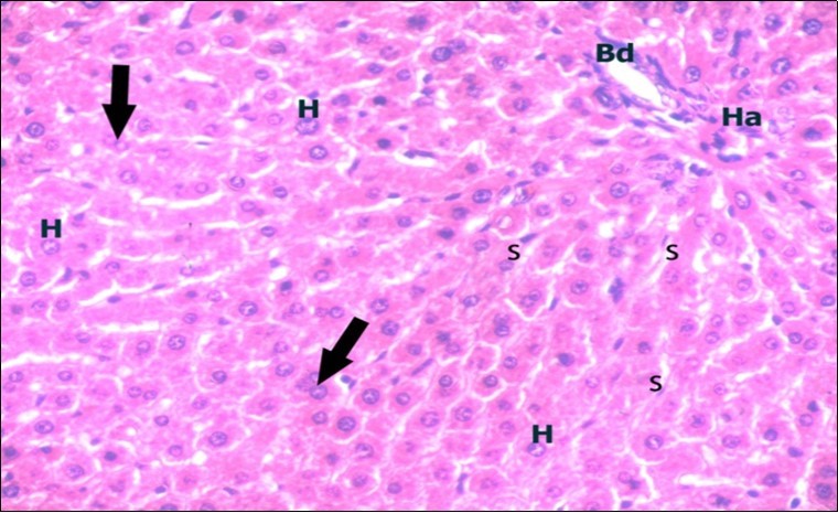 A photomicrograph of a section in the liver of a control adult albino rat showing portal area containing bile duct (Bd) and hepatic artery (Ha).                        Polygonal hepatocytes (H) with rounded vesicular nuclei and acidophilic                         cytoplasm can be observed. Narrow radiating blood sinusoids (s) in between liver cords and their lining endothelium are seen. Binucleated cells are also seen (thick arrows). (H&E  X400) 