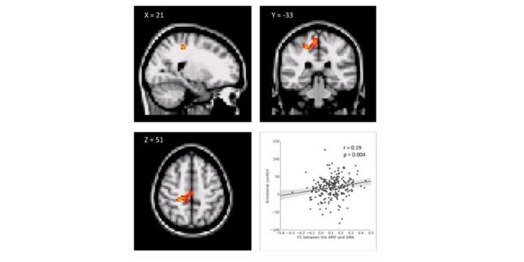 International Journal of Psychotherapy Practice and Research-Resting state